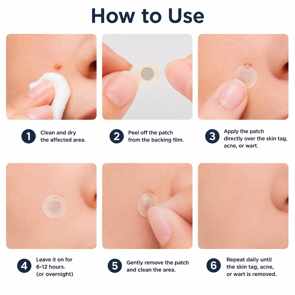 ✨Soraloza® 2-in-1 Microneedle & Hydrocolloid Patch🍀 | Removes raised moles, acne, flat warts, and skin tags | Helps improve wrinkles, scars, and blemishes | Invisible patches for face and body