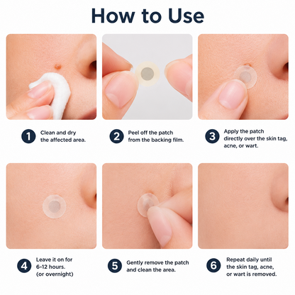 ✨Soraloza® 2-in-1 Microneedle & Hydrocolloid Patch🍀 | Removes raised moles, acne, flat warts, and skin tags | Helps improve wrinkles, scars, and blemishes | Invisible patches for face and body