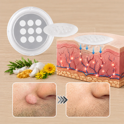 ✨Soraloza® 2-in-1 Microneedle & Hydrocolloid Patch🍀 | Removes raised moles, acne, flat warts, and skin tags | Helps improve wrinkles, scars, and blemishes | Invisible patches for face and body